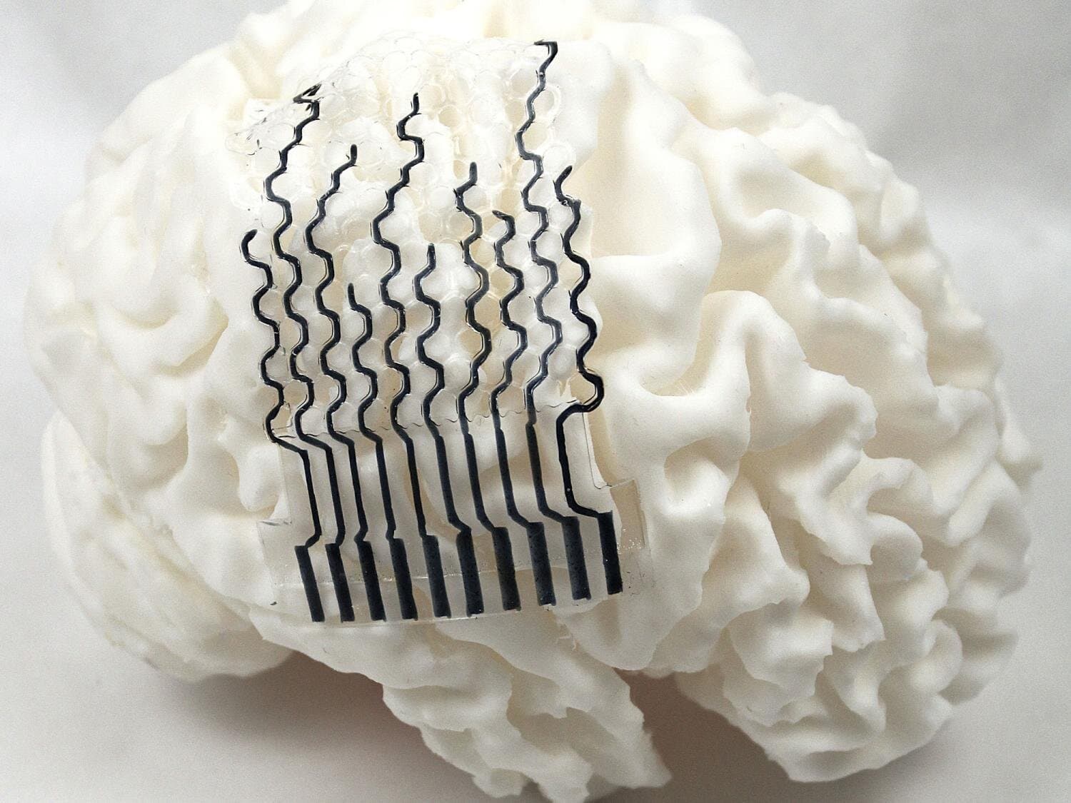 3D-printed brain sensors may unlock personalized neural monitoring