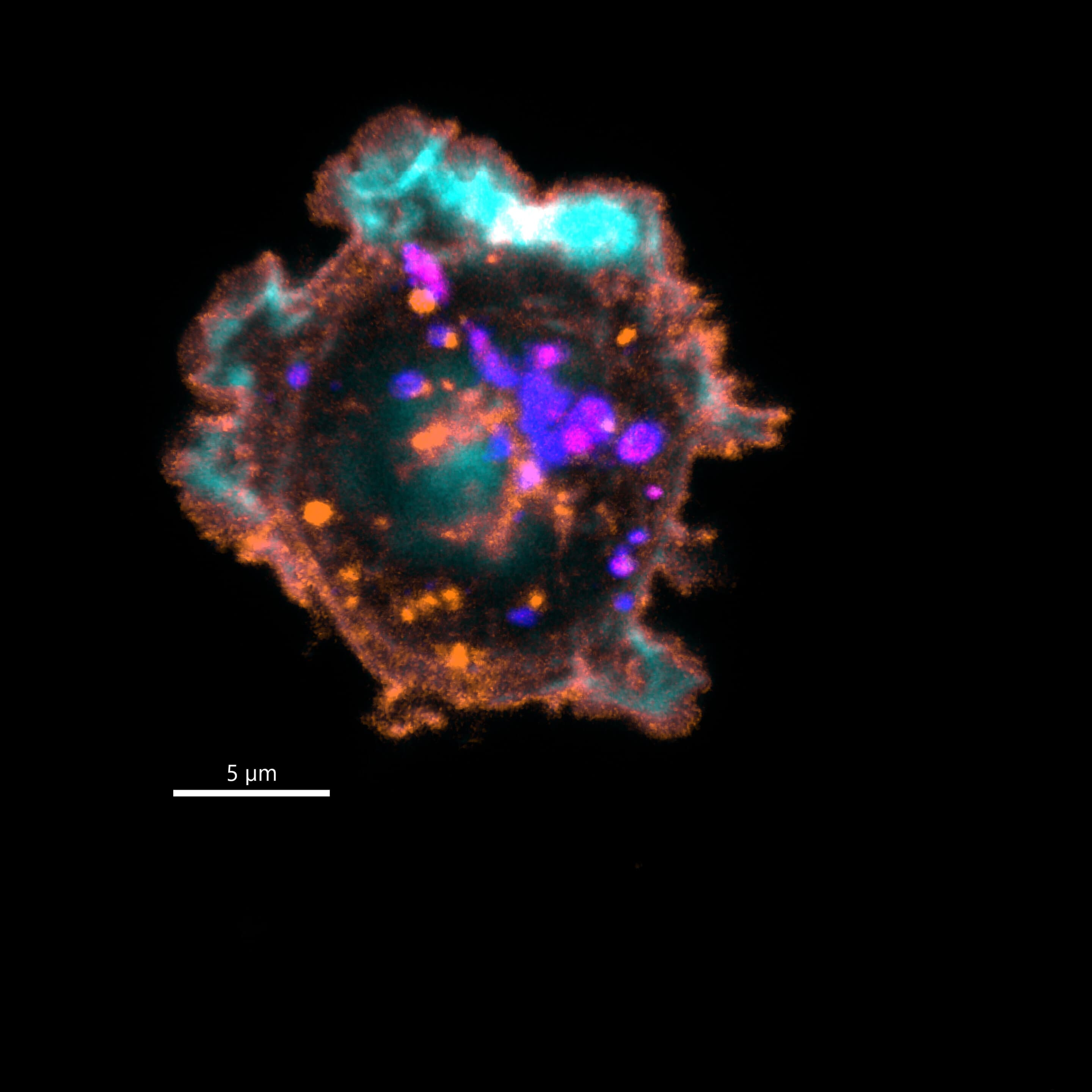 For 30 years, doctors chased the wrong immune culprit behind this rare inflammatory disease