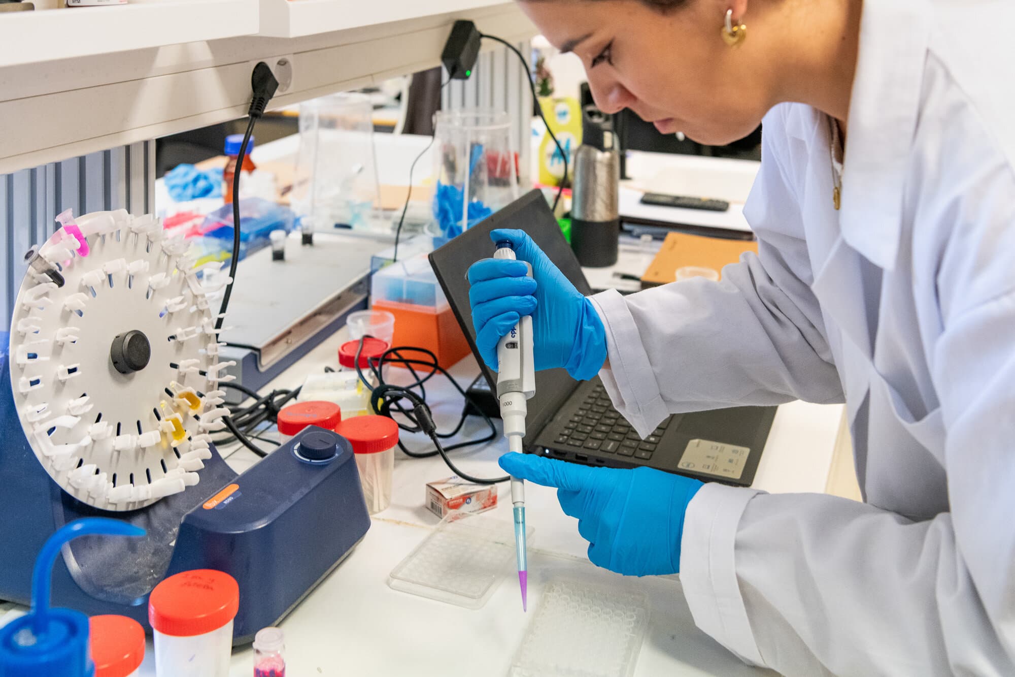 New biosensor detects active tuberculosis in 60 minutes using a fluorescent protein signal