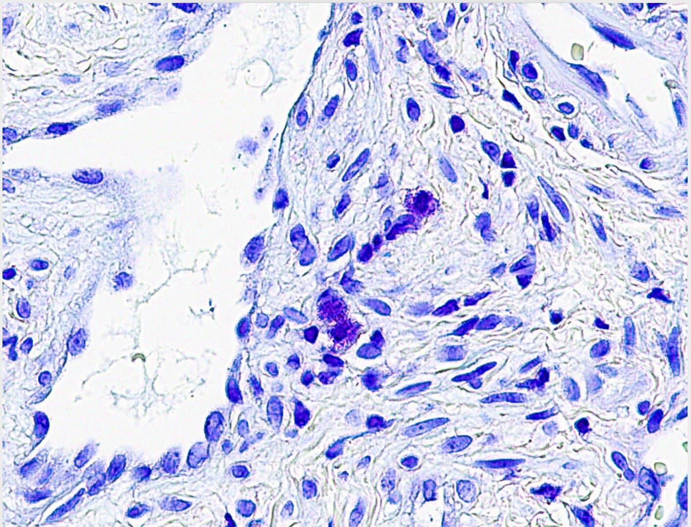 Airborne Toxins Trigger Chronic Sinus Disease in Veterans