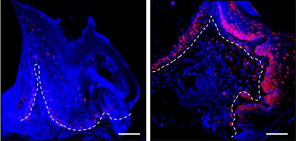 Gum Cells Detect Shift in Mouth Microbes That May Trigger Inflammation, Gum Disease (via nidcr.nih.gov)