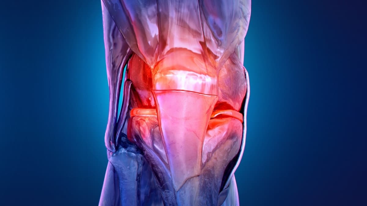 Osteoarthritis Is Appearing in Younger Adults, Triggering Decades of Discomfort (via sciencealert.com)