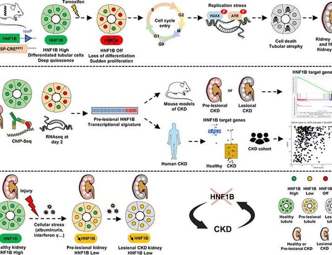 HNF1B Study Points to Feed-Forward Loop in Kidney Disease Progression (via lifescience.net)