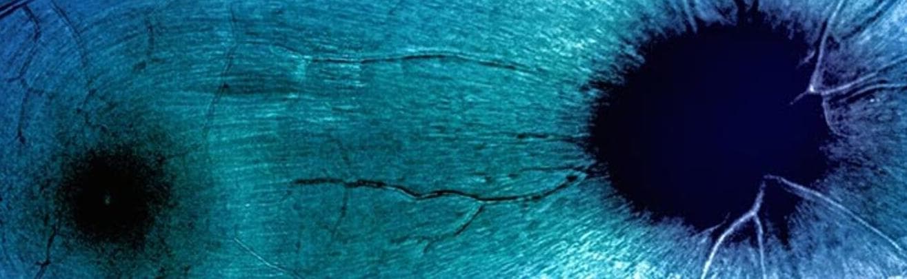 Optic Nerve Research Update - Eye & Ear Foundation of Pittsburgh (via eyeandear.org)