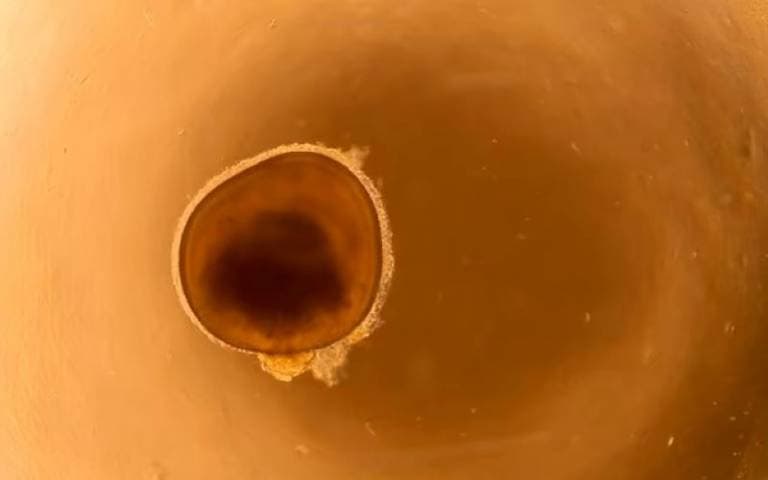 Lab-Grown Retina Study Reveals Gene Clue in Eye Disease (via glaucoma.ph)