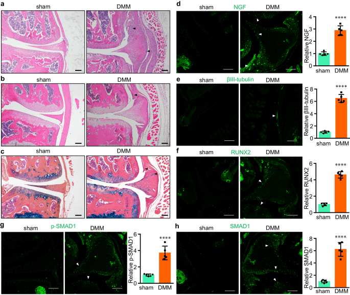 Nerve growth factor receptor limits inflammation to promote remodeling and repair of osteoarthritic joints - Nature Communications (via nature.com)