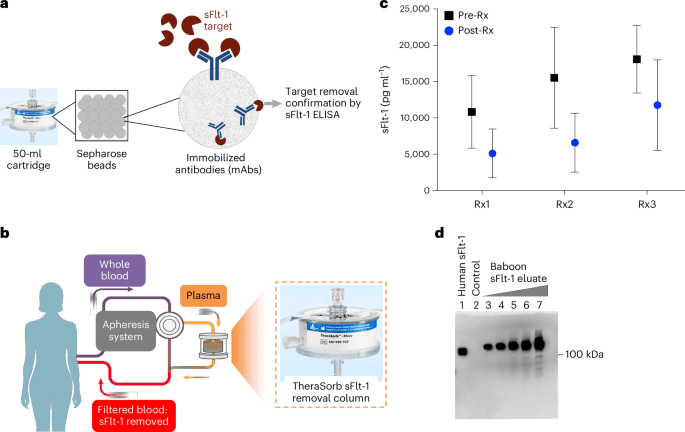Targeted removal of soluble Fms-like tyrosine kinase 1 in very preterm preeclampsia: a pilot trial - Nature Medicine