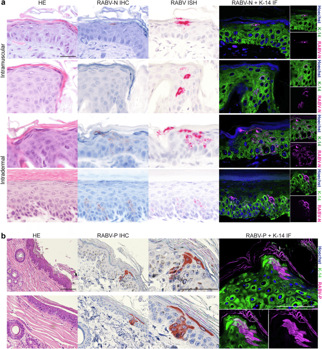 Exploring the role of infected keratinocytes during rabies virus infection - npj Viruses (via nature.com)