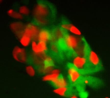 A “stemness checkpoint” helps control stem cell identity (via stemcell.keck.usc.edu)