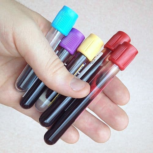 Collection of vacutainer blood sample tubes for laboratory biomarker analysis